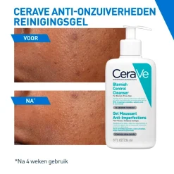 CeraVe Anti-Onzuiverheden Reinigingsgel< Dermacare|Gezichtsreiniging