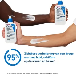 CeraVe Intensief Hydraterende Lotion< Bodylotion|Dermacare