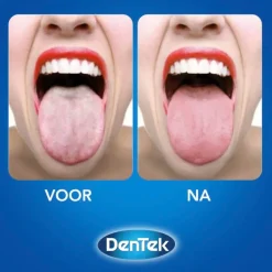 Orabrush 2-in-1 Tongreiniger|Dentek Best