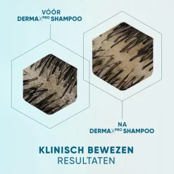 Head & Shoulders DermaXPro by Revitaliseert Antiroosshampoo< Shampoo