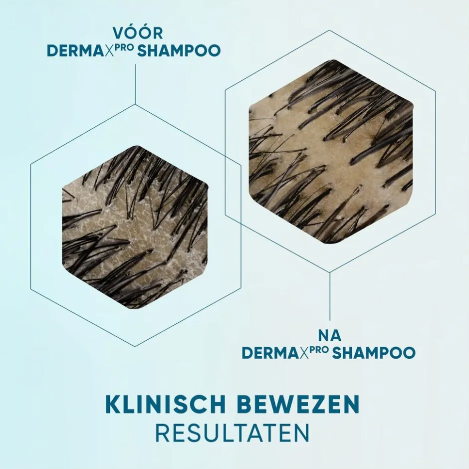 Head & Shoulders DermaXPro by Kalmeert Antiroosshampoo< Shampoo