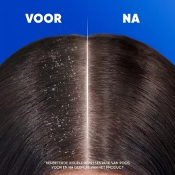 Head & Shoulders Classic Antiroosshampoo< Shampoo