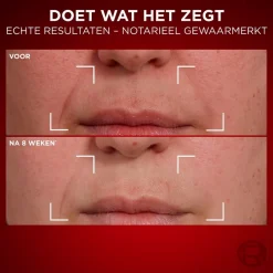 L'Oréal Paris Revitalift Laser Anti-Rimpel Dagcrème|L'Oreal Paris Online