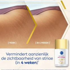 Luminous630 Anti-Striae/Anti-Striemen Body Oil-Serum|Nivea Sale