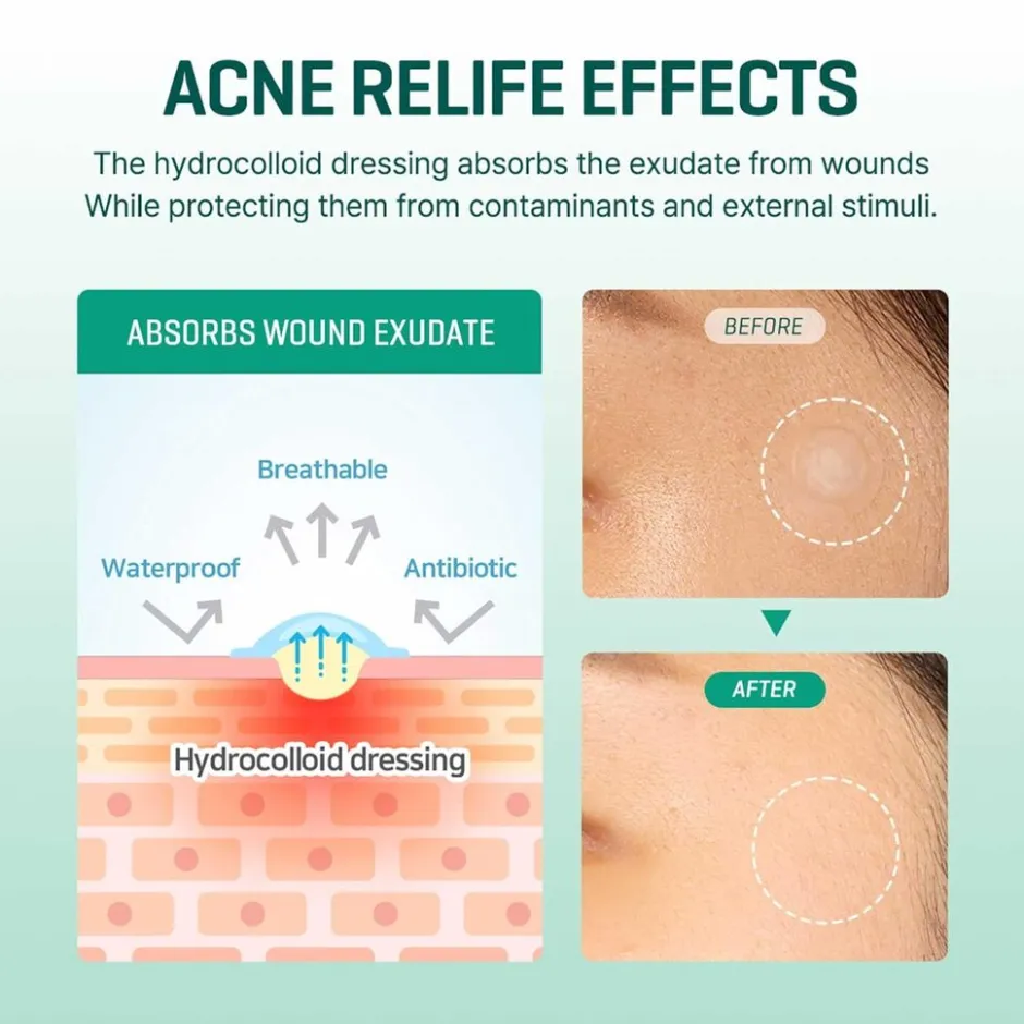 SOME BY MI Clear Spot Patch|SOMEBYMI Hot