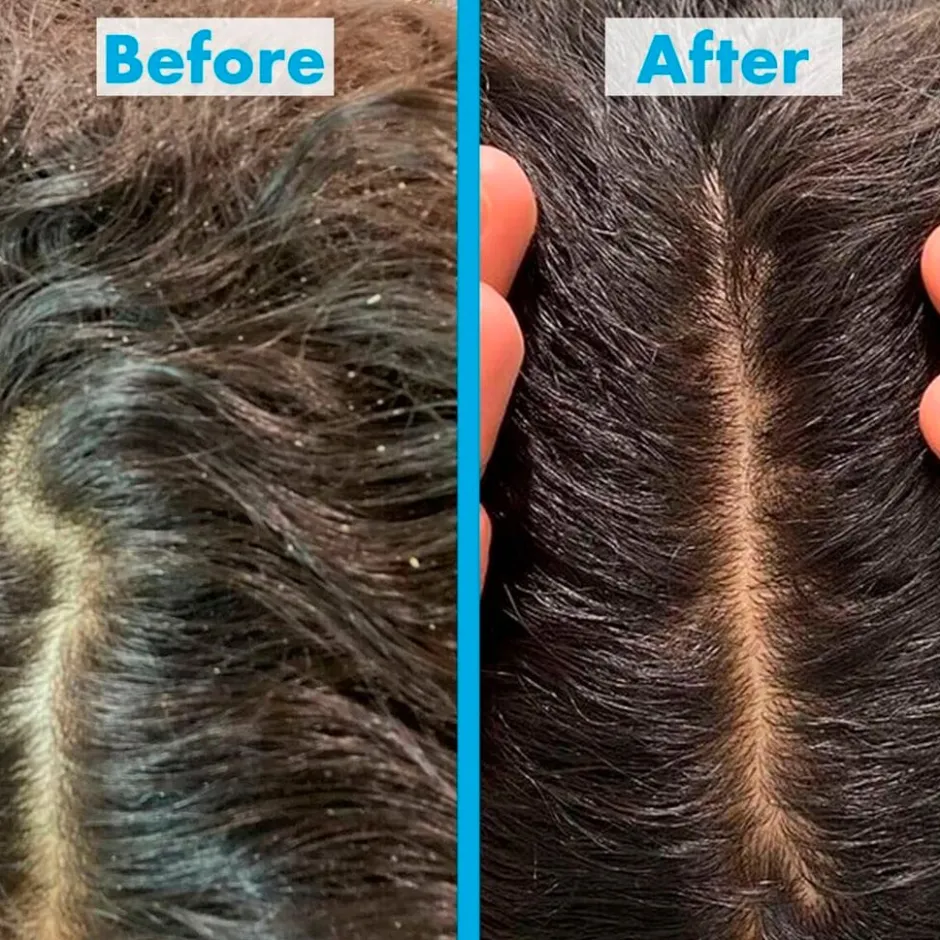 Scalp Restore Shampoo|Umberto Giannini New